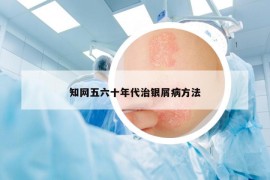 知網(wǎng)五六十年代治銀屑病方法