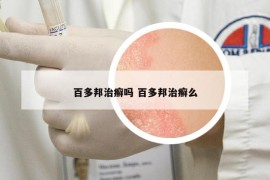 百多邦治癬嗎 百多邦治癬么