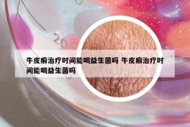 牛皮癬治療時間能喝益生菌嗎 牛皮癬治療時間能喝益生菌嗎