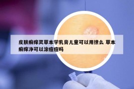 皮膚癬癢靈草本學(xué)乳膏兒童可以用撩么 草本癬癢凈可以涂痘痘嗎