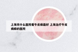 上海市什么醫(yī)院看牛皮癬最好 上海治療牛皮病癬的醫(yī)院