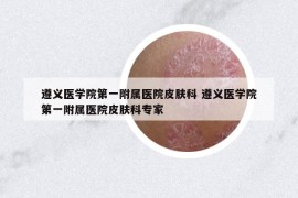 遵義醫(yī)學(xué)院第一附屬醫(yī)院皮膚科 遵義醫(yī)學(xué)院第一附屬醫(yī)院皮膚科專家