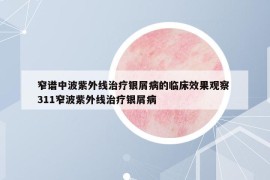 窄譜中波紫外線治療銀屑病的臨床效果觀察 311窄波紫外線治療銀屑病