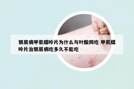 銀屑病甲氨蝶呤片為什么與葉酸同吃 甲氨蝶呤片治銀屑病吃多久不能吃