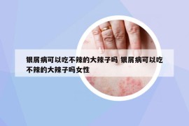 銀屑病可以吃不辣的大辣子嗎 銀屑病可以吃不辣的大辣子嗎女性