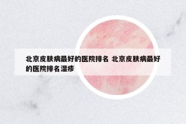 北京皮膚病最好的醫(yī)院排名 北京皮膚病最好的醫(yī)院排名濕疹