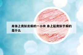 身體上類似皮癬的一小塊 身上起類似于癬的是什么