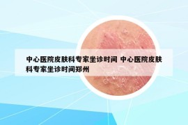 中心醫(yī)院皮膚科專家坐診時間 中心醫(yī)院皮膚科專家坐診時間鄭州