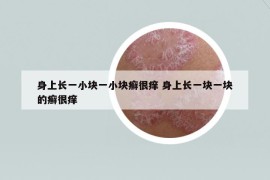 身上長一小塊一小塊癬很癢 身上長一塊一塊的癬很癢