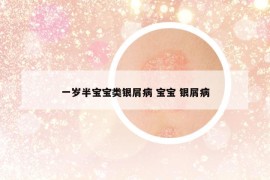 一歲半寶寶類銀屑病 寶寶 銀屑病