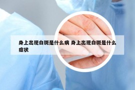 身上出現(xiàn)白斑是什么病 身上出現(xiàn)白斑是什么癥狀