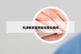天津哪家醫(yī)院能檢查白癜風