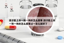 孩子臉上白一塊一塊的怎么回事 孩子臉上白一塊一塊的怎么回事過一會兒就好了