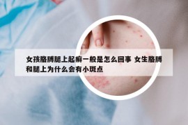 女孩胳膊腿上起癬一般是怎么回事 女生胳膊和腿上為什么會有小斑點