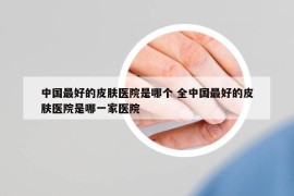 中國(guó)最好的皮膚醫(yī)院是哪個(gè) 全中國(guó)最好的皮膚醫(yī)院是哪一家醫(yī)院
