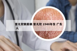 曾凡欽銀屑病 曾凡欽 1948年生 廣東 人