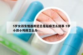 5歲女孩生殖器附近總是起癬怎么回事 5歲小孩小雞癢怎么辦