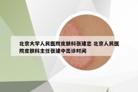 北京大學(xué)人民醫(yī)院皮膚科張建忠 北京人民醫(yī)院皮膚科主任張建中出診時間