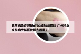 銀屑病治療領(lǐng)銜n鴻業(yè)皮膚病醫(yī)院 廣州鴻業(yè)皮膚病?？漆t(yī)院搬去哪里了