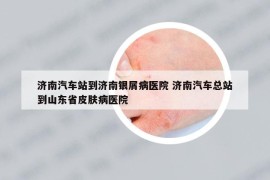 濟南汽車站到濟南銀屑病醫(yī)院 濟南汽車總站到山東省皮膚病醫(yī)院