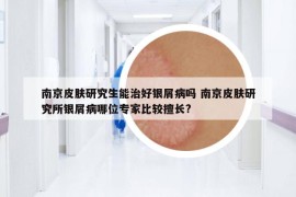 南京皮膚研究生能治好銀屑病嗎 南京皮膚研究所銀屑病哪位專家比較擅長?