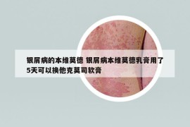 銀屑病的本維莫德 銀屑病本維莫德乳膏用了5天可以換他克莫司軟膏