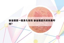郁金銀屑一般多久有效 郁金銀屑片的效果咋樣?