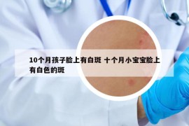 10個(gè)月孩子臉上有白斑 十個(gè)月小寶寶臉上有白色的斑