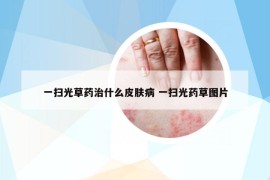 一掃光草藥治什么皮膚病 一掃光藥草圖片