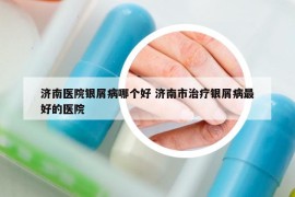 濟(jì)南醫(yī)院銀屑病哪個(gè)好 濟(jì)南市治療銀屑病最好的醫(yī)院