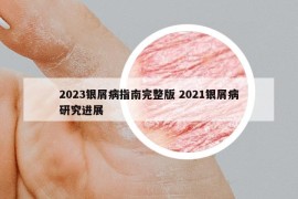 2023銀屑病指南完整版 2021銀屑病研究進(jìn)展