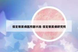 保定銀屑病醫(yī)院都興南 保定銀屑病研究院