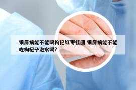 銀屑病能不能喝枸杞紅棗桂圓 銀屑病能不能吃枸杞子泡水喝?