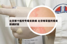 北京那個醫(yī)院?？雌つw病 北京哪家醫(yī)院看皮膚病好些