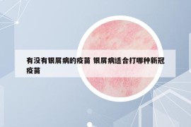 有沒有銀屑病的疫苗 銀屑病適合打哪種新冠疫苗