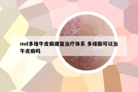 md多維牛皮癬康復(fù)治療體系 多維酸可以治牛皮癬嗎