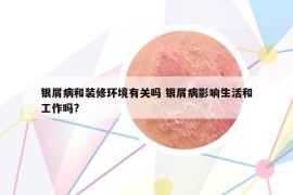 銀屑病和裝修環(huán)境有關嗎 銀屑病影響生活和工作嗎?