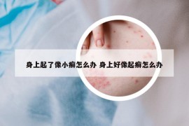 身上起了像小癬怎么辦 身上好像起癬怎么辦