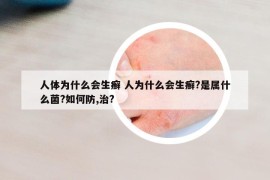 人體為什么會生癬 人為什么會生癬?是屬什么菌?如何防,治?