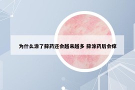 為什么涂了蘚藥還會(huì)越來(lái)越多 蘚涂藥后會(huì)癢