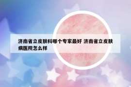 濟南省立皮膚科哪個專家最好 濟南省立皮膚病醫(yī)院怎么樣