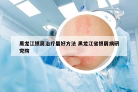 黑龍江銀屑治療最好方法 黑龍江省銀屑病研究院
