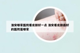 淮安哪家醫(yī)院看皮膚好一點 淮安看皮膚最好的醫(yī)院是哪家