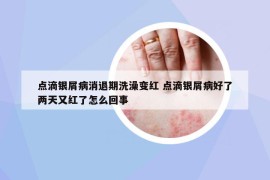 點(diǎn)滴銀屑病消退期洗澡變紅 點(diǎn)滴銀屑病好了兩天又紅了怎么回事