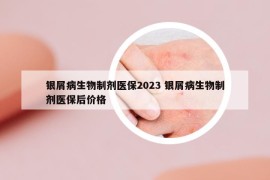 銀屑病生物制劑醫(yī)保2023 銀屑病生物制劑醫(yī)保后價格