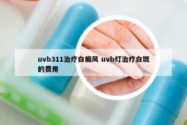 uvb311治療白癜風(fēng) uvb燈治療白斑的費(fèi)用