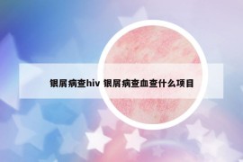 銀屑病查hiv 銀屑病查血查什么項(xiàng)目