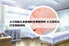 小三陽能扎皮膚病的生物制劑嗎 小三陽可以打生物制劑嗎