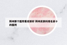 荊州那個(gè)醫(yī)院看皮膚好 荊州皮膚科排名前十的醫(yī)院