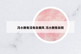 馮小剛有沒(méi)有白癜風(fēng) 馮小剛有白斑